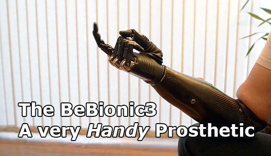 bebionic3 myoelectric prosthetic hand